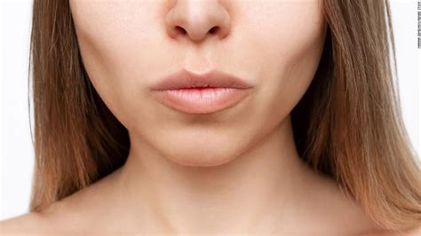 Why everyone is suddenly talking about buccal fat removal